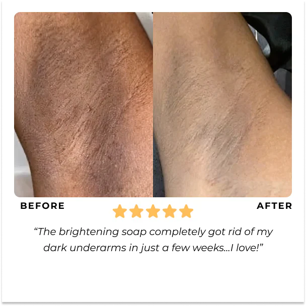 Turmeric & Kojic Acid Brightening Soap