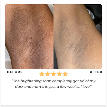 Turmeric & Kojic Acid Brightening Soap