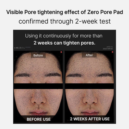 Mirco Pore Pads (AHA + BHA) |Acne-prone skin care