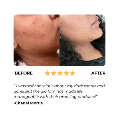 Turmeric & Kojic Acid Brightening Soap