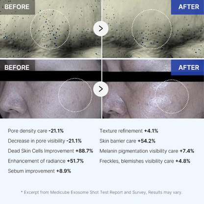 Ultimate Dark Spot Removal Duo: Exosome Micro-Needle + Vitamin C Serum